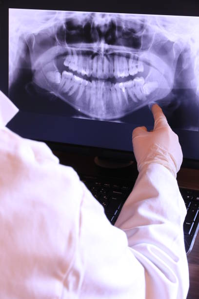 Best After-Hours Emergency Dentist in Nash, TX