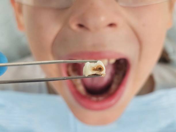 Best Emergency Orthodontic Repairs in Nash, TX